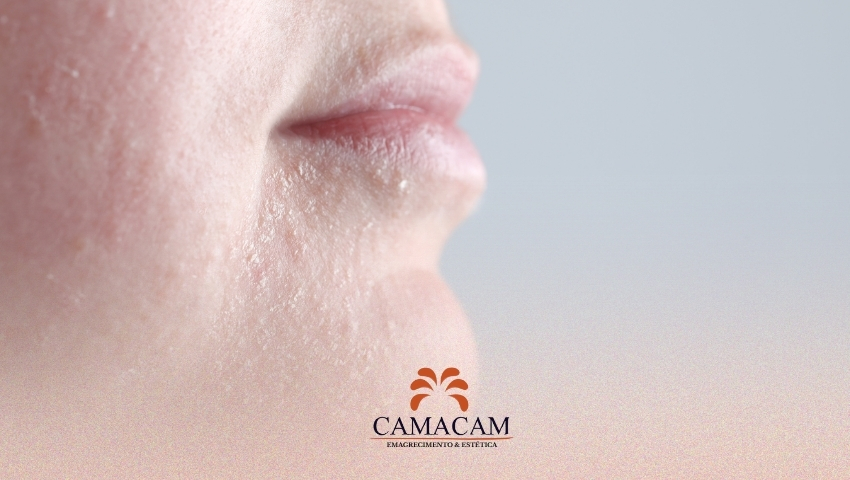 Camacam