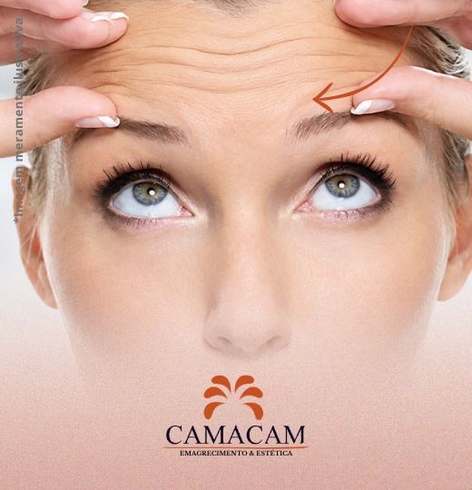 Toxina botulínica (Botox) | 2