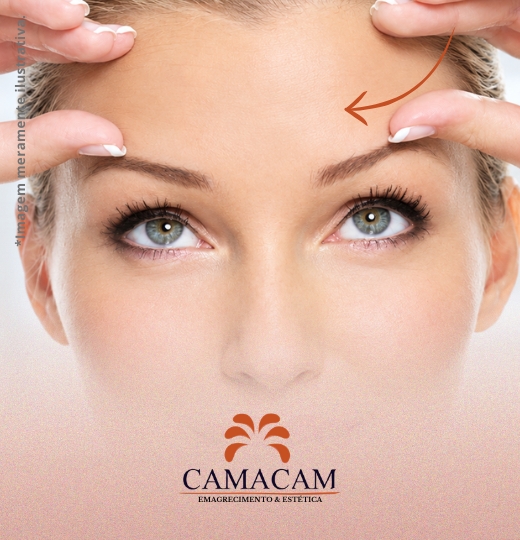 Toxina botulínica (Botox) | 3