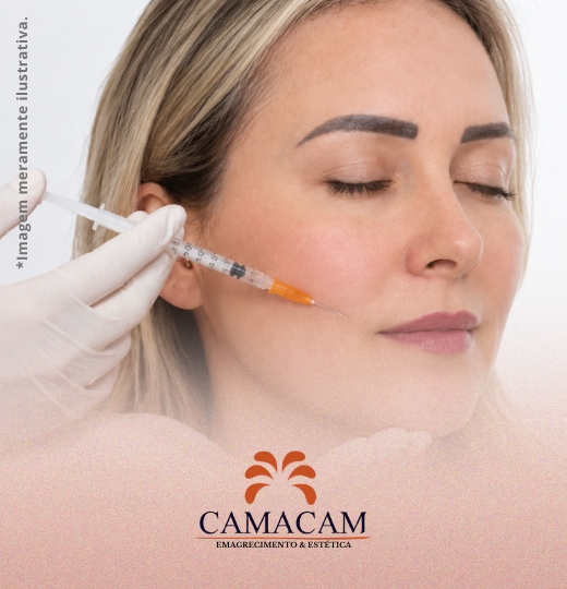 Preenchimento facial com ácido hialurônico