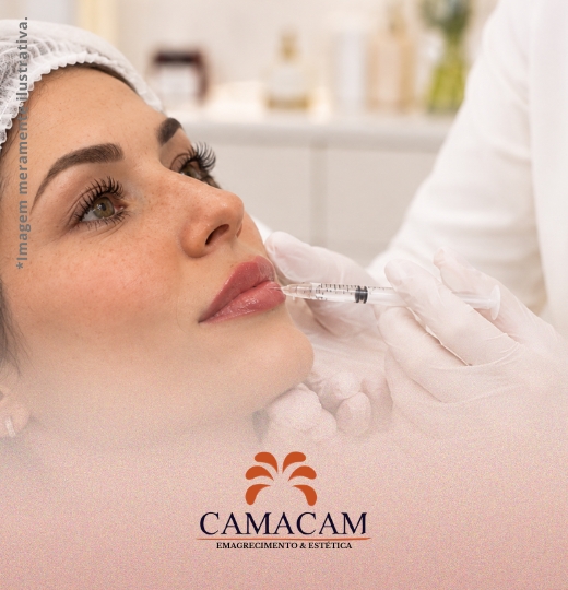 Preenchimento labial | 1