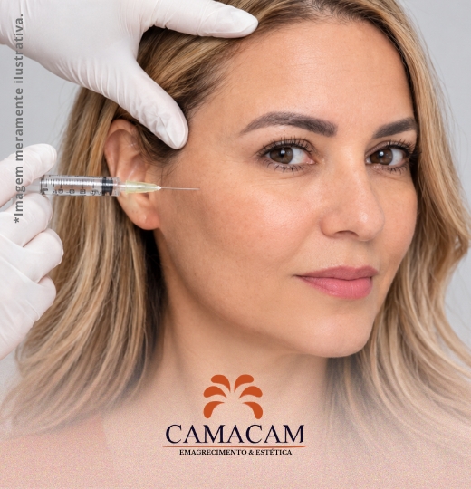 Bioestimuladores de colágeno