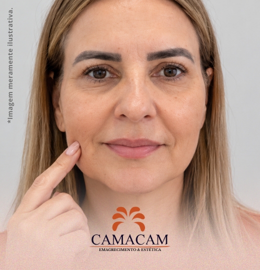Bioestimuladores de colágeno | 3