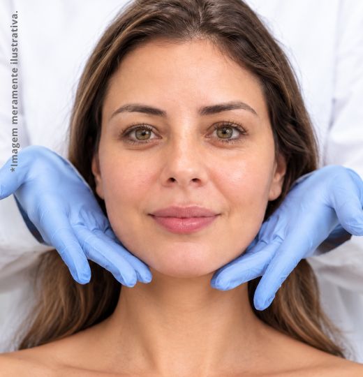 Intradermoterapia facial