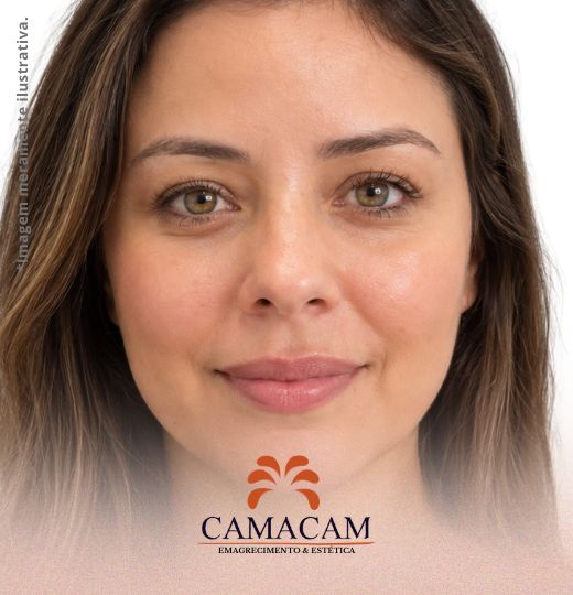 Intradermoterapia facial | 3