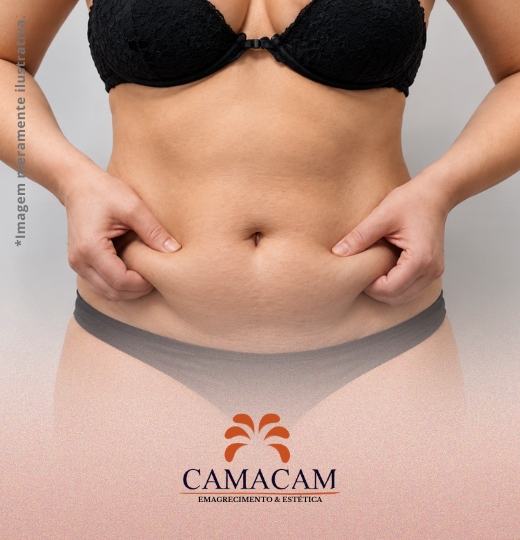Intradermoterapia corporal